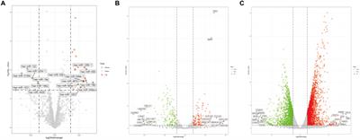 Elucidating the Molecular Mechanism of Ischemic Stroke Using Integrated Analysis of miRNA, mRNA, and lncRNA Expression Profiles